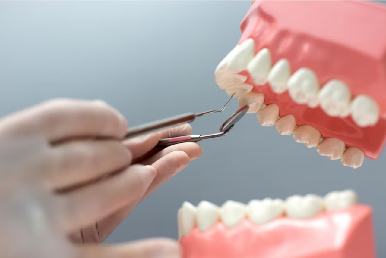 ortodontik-tedavi-sonrasi-retainer